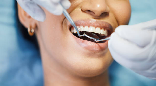Best Broken or Cracked Tooth Emergency Dentist in Boise, ID